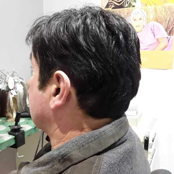 Prothèse cheveux Les Sables-d'Olonne