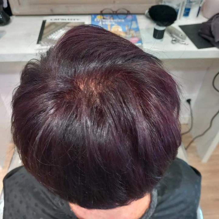 Prothèse capillaire Les Sables-d'Olonne