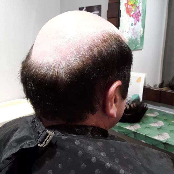 Prothèse capillaire Les Sables-d'Olonne