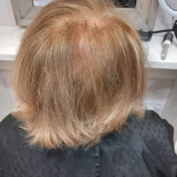 Prothèse capillaire Les Sables-d'Olonne