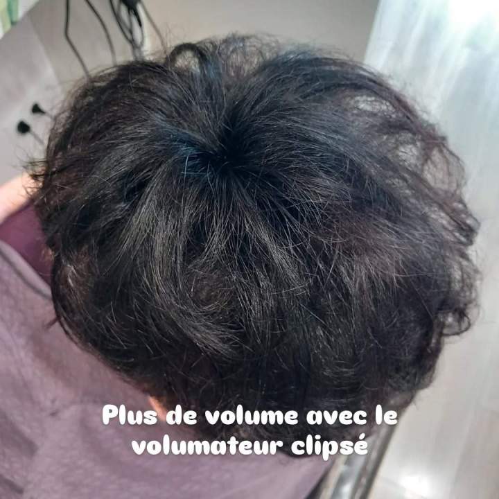 Prothesese capillaire après 1